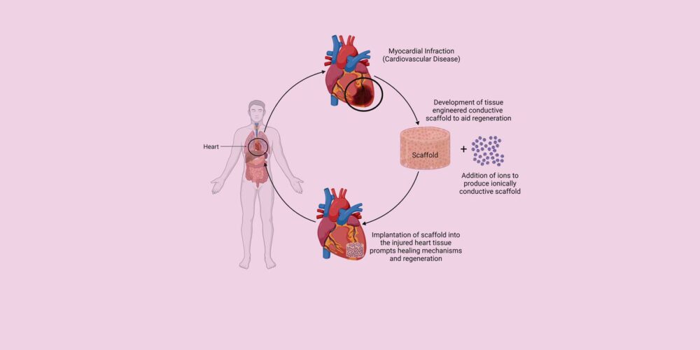 This image represents research focused on the development and implementation of tissue engineered conductive scaffold into injured heart tissue to prompt healing mechanisms and regeneration.