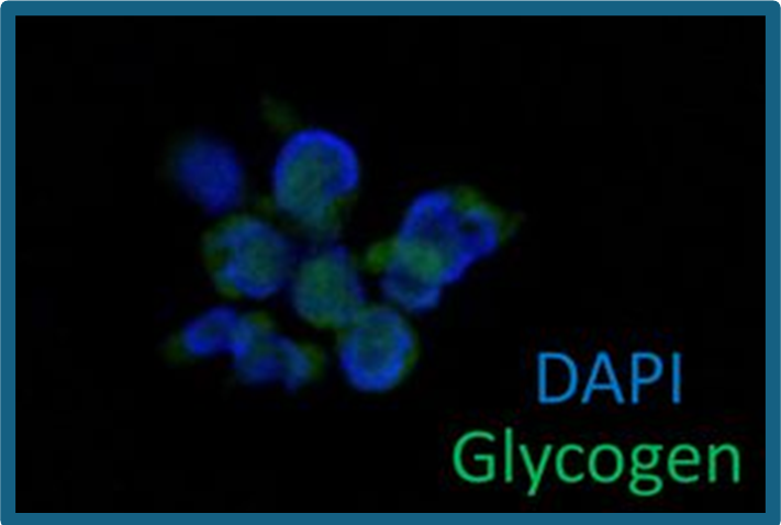 MAIT cells with their ''packed lunch'' of glycogen might be important in obesity-associated cancer