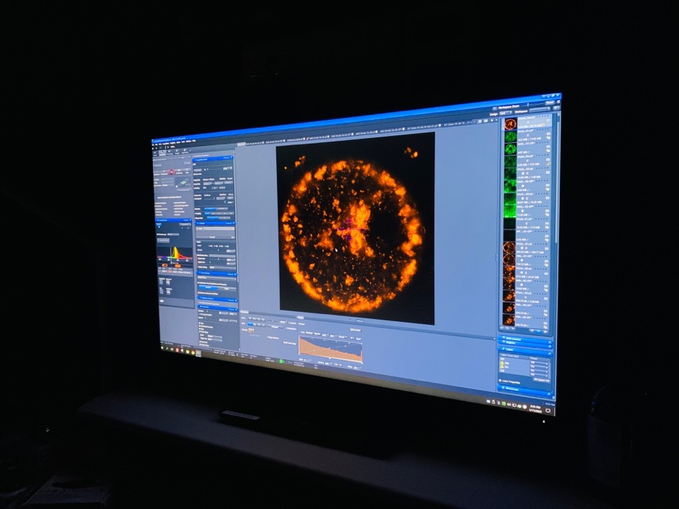Image optimizing the oocyte. January 2025. Image optimizing the oocyte. January 2025.